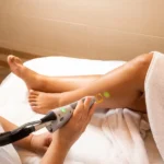 Female Laser Hair Removal and Hormonal Changes: How Life Stages Affect Results
